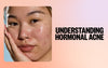 Understanding Hormonal Acne and How to Treat It