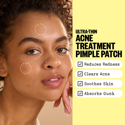 Woman with Acne Day Dot pimple patches on her face and promotional text for acne treatment pimple patches hover next to the woman.
