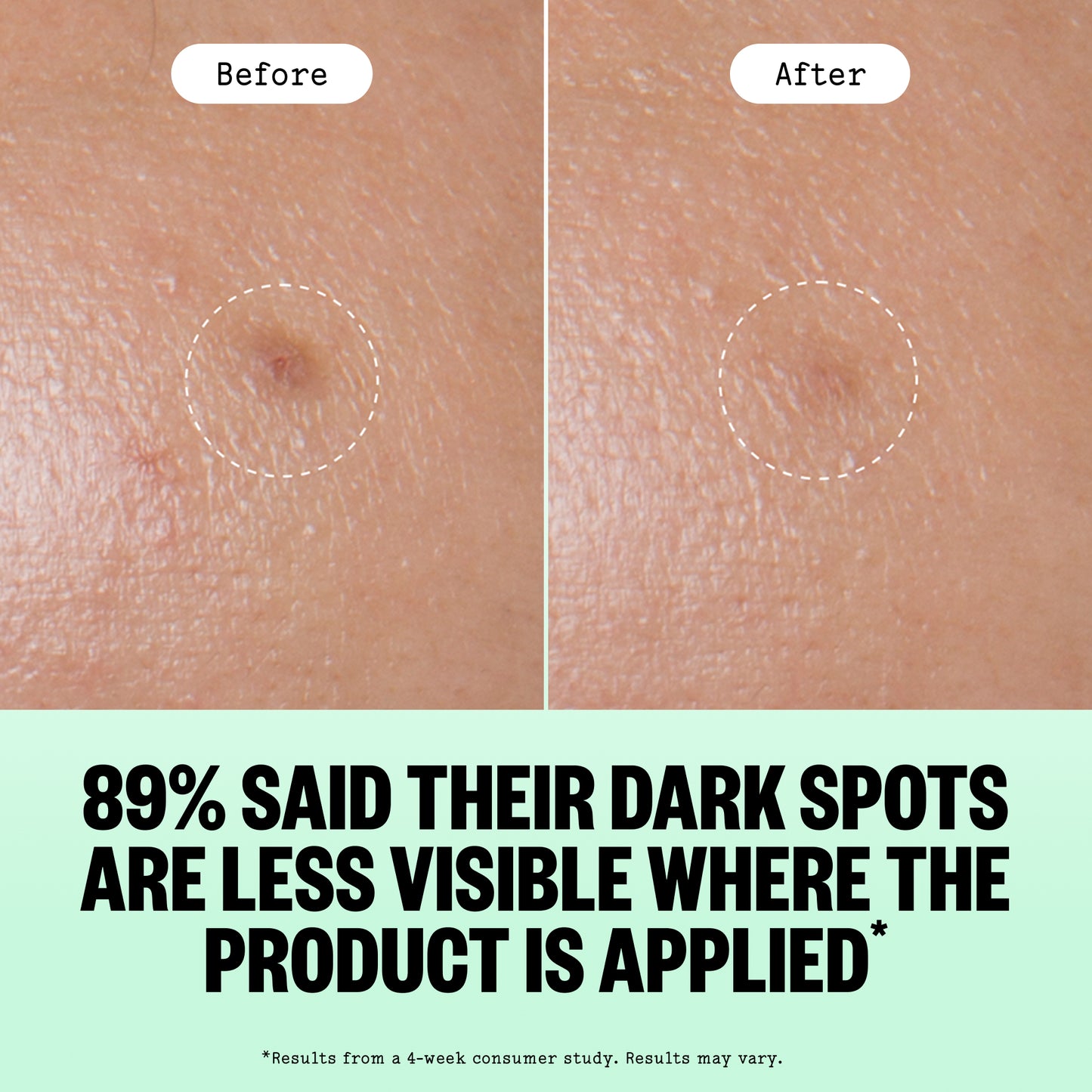 Dark Spots Microneedling Dots