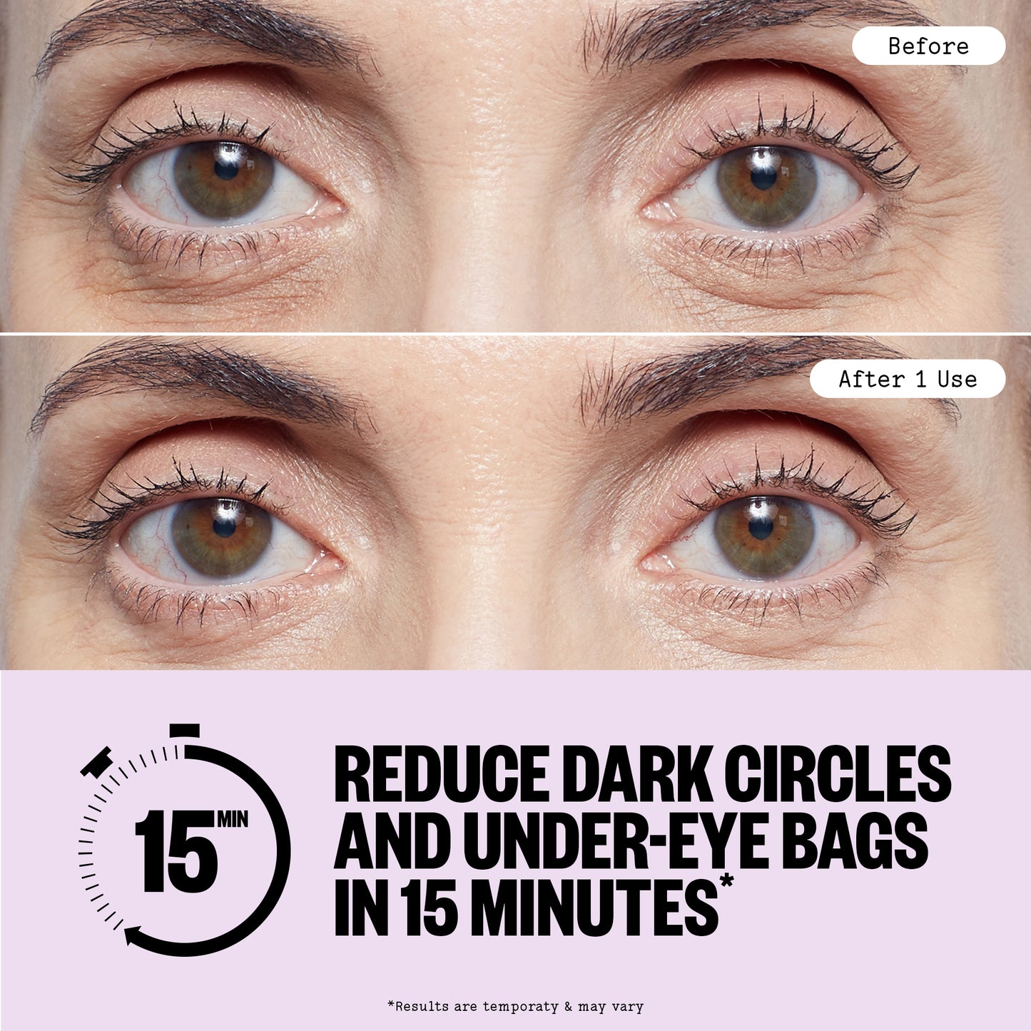 Before and after comparison of eye area treatment with text claiming to reduce dark circles and under-eye bags.