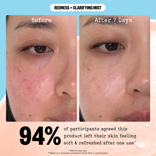 Redness + Hydrating Clarifying Mist