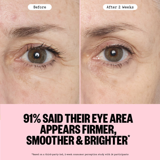 Before and after comparison of eye area treatment showing firmer, smoother, and brighter appearance.