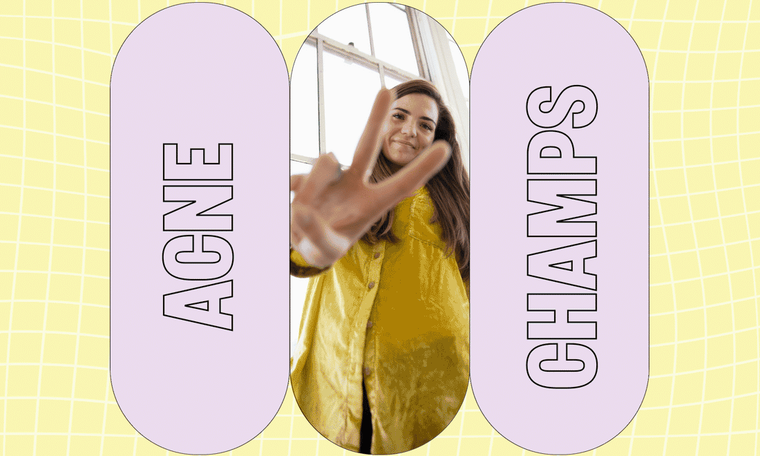 Acne Champs x Jenny