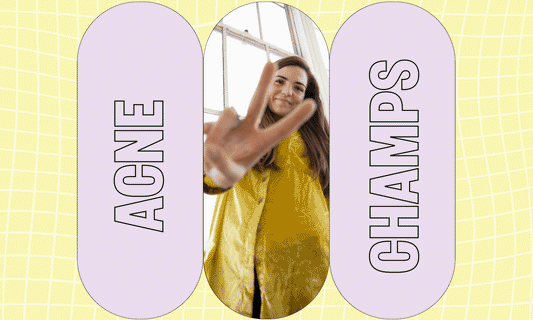 Acne Champs x Jenny