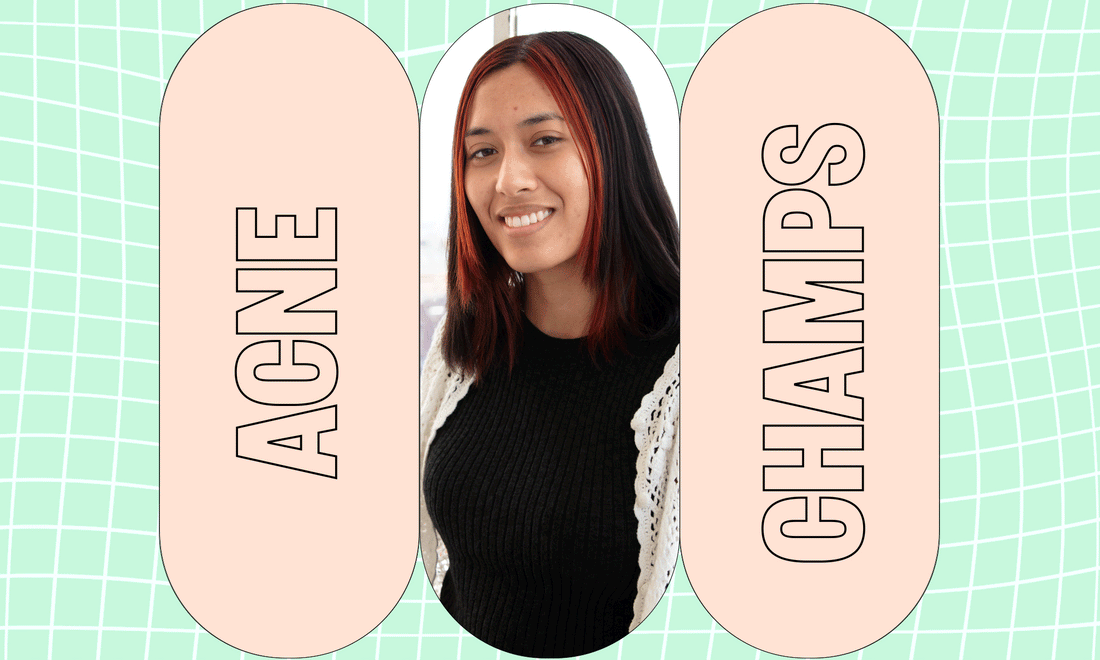 Acne Champs x Chantal