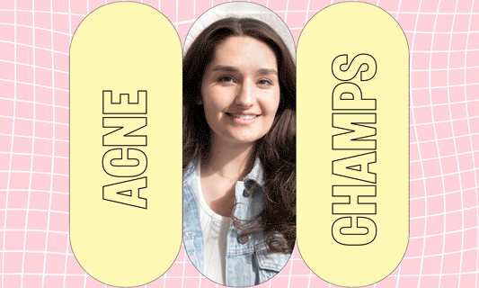 Acne Champs x Kenna