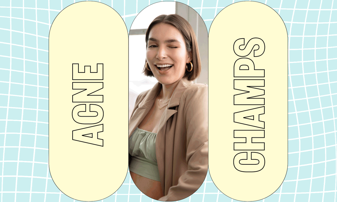 Acne Champs x Cosette
