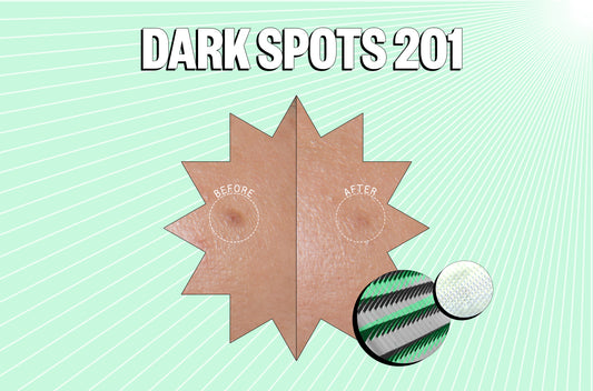 What causes dark spots and skin discoloration?