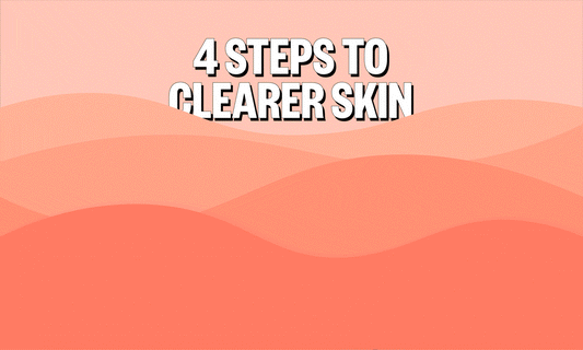Your Easy & Effective 4-Step Acne Routine