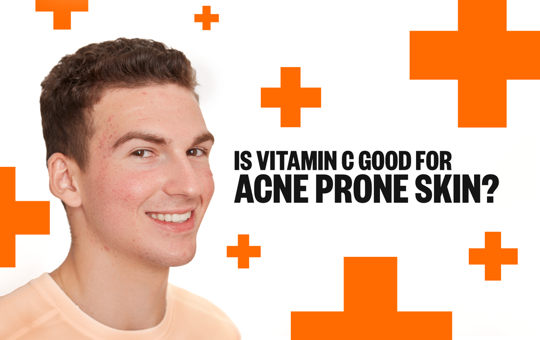 Is Vitamin C Good for Acne Prone Skin? Peace Out Skincare
