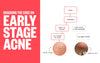 What Does Early Stage Acne Look Like?