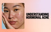 Understanding Hormonal Acne and How to Treat It