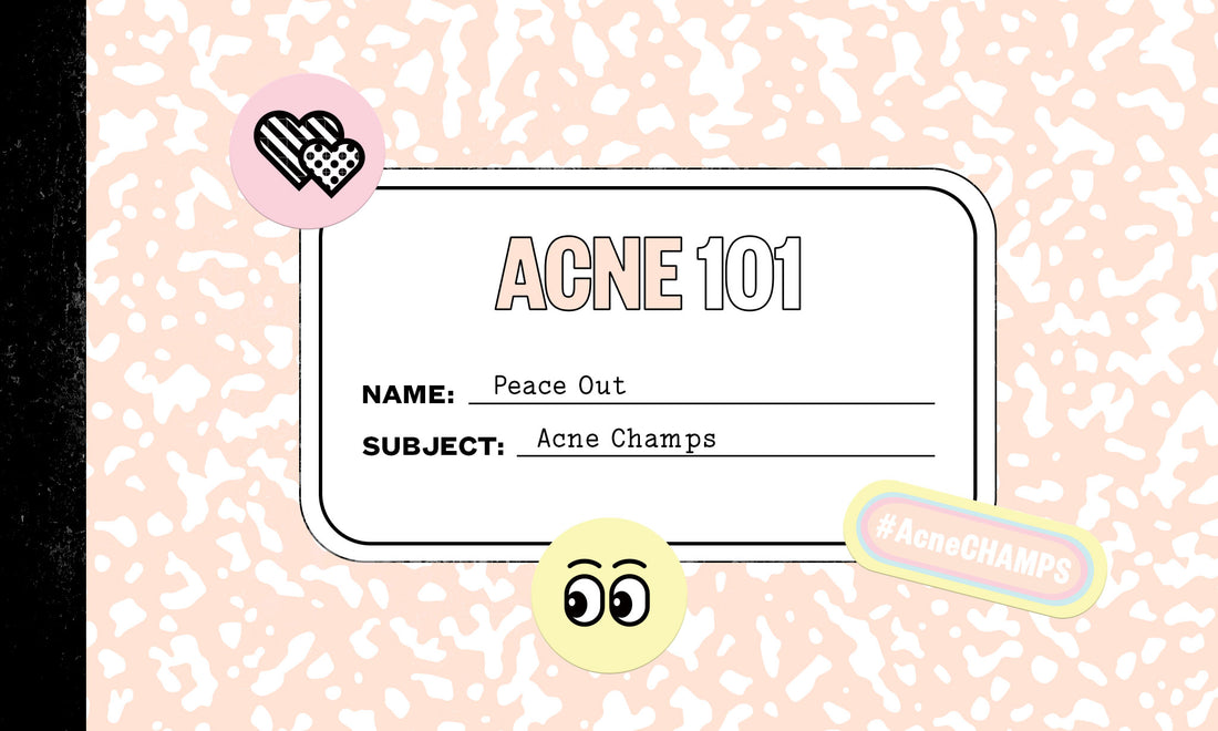 ACNE 101
