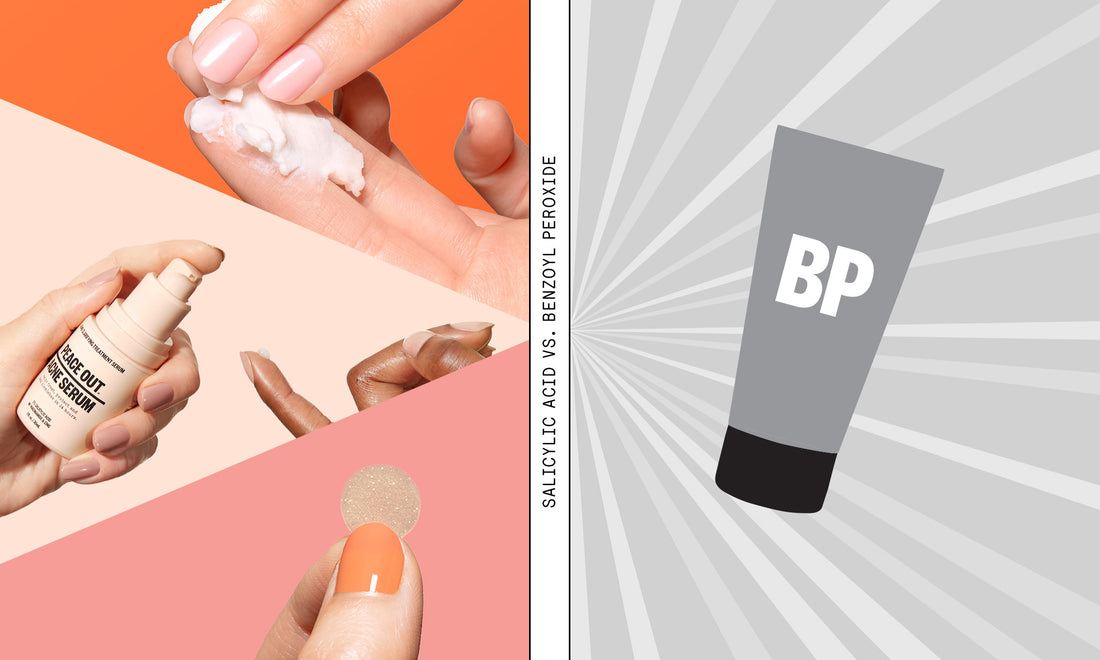 SALICYLIC ACID VS BENZOYL PEROXIDE