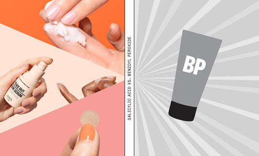 SALICYLIC ACID VS BENZOYL PEROXIDE