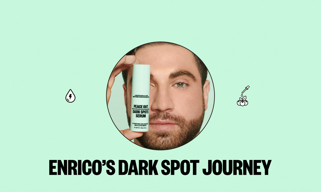 enrico dark spots journey