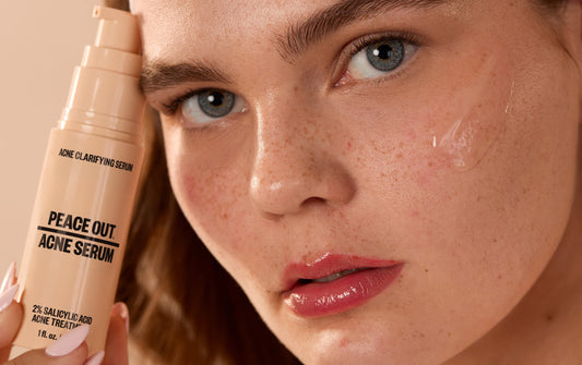 Peace Out Acne Serum bottle held up to a woman's face