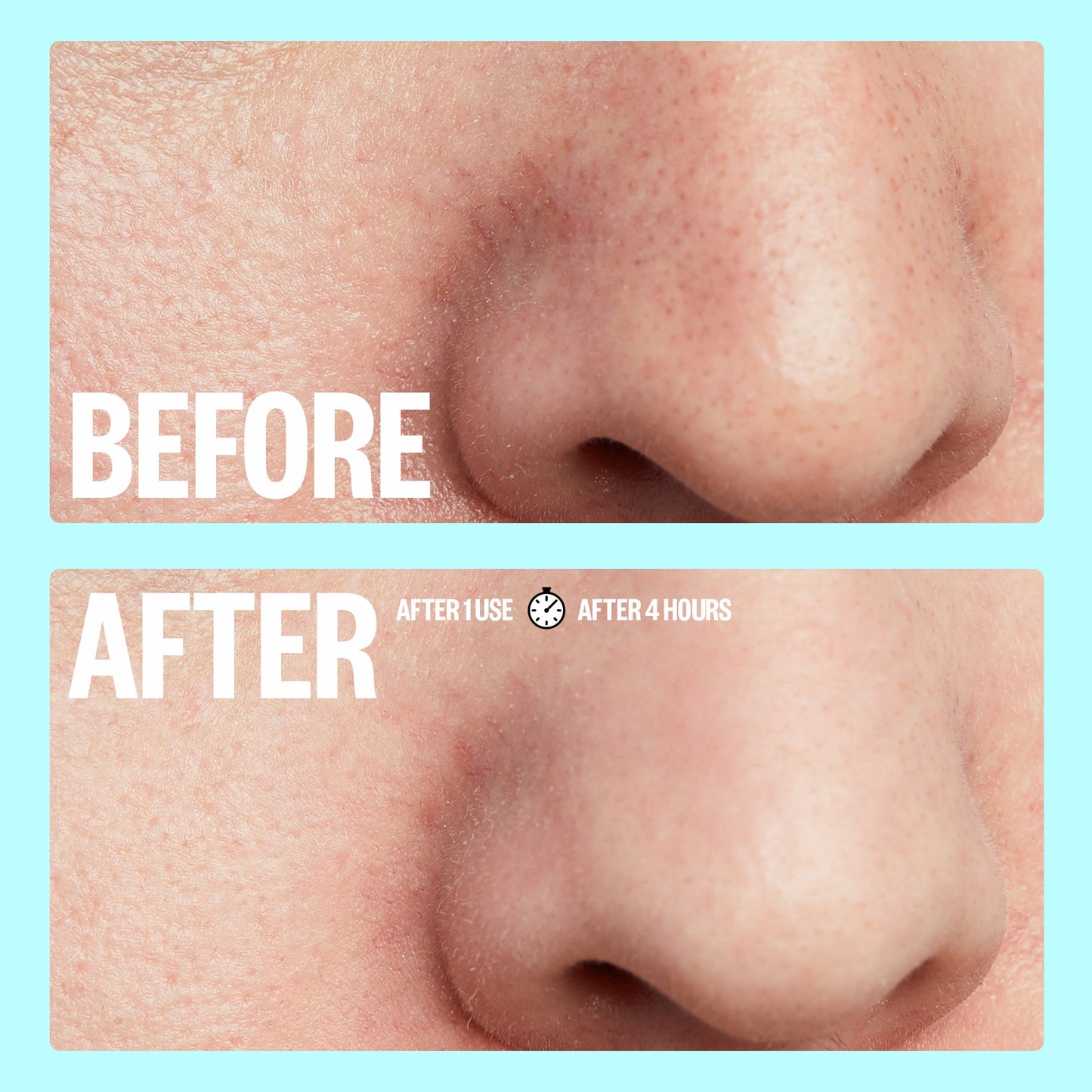 Pore Minimizing Strips (CAN)