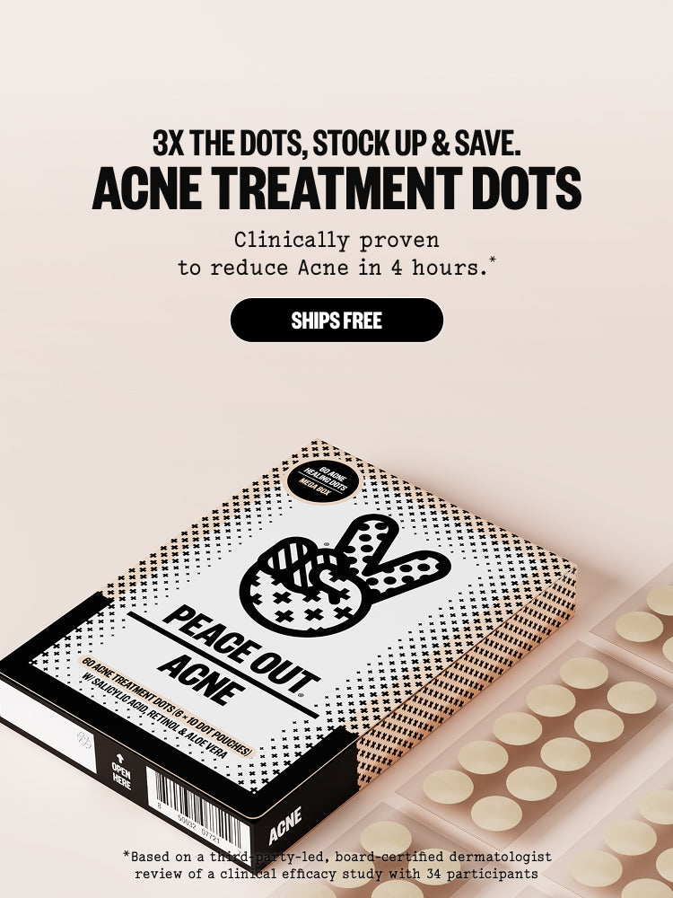 Acne Treatment Dots now available in a 60 pack - Mobile home page banner highlighting that Acne Treatment Dots are clinically proven to reduce acne in 4 Hours. - Order now Ships Free
