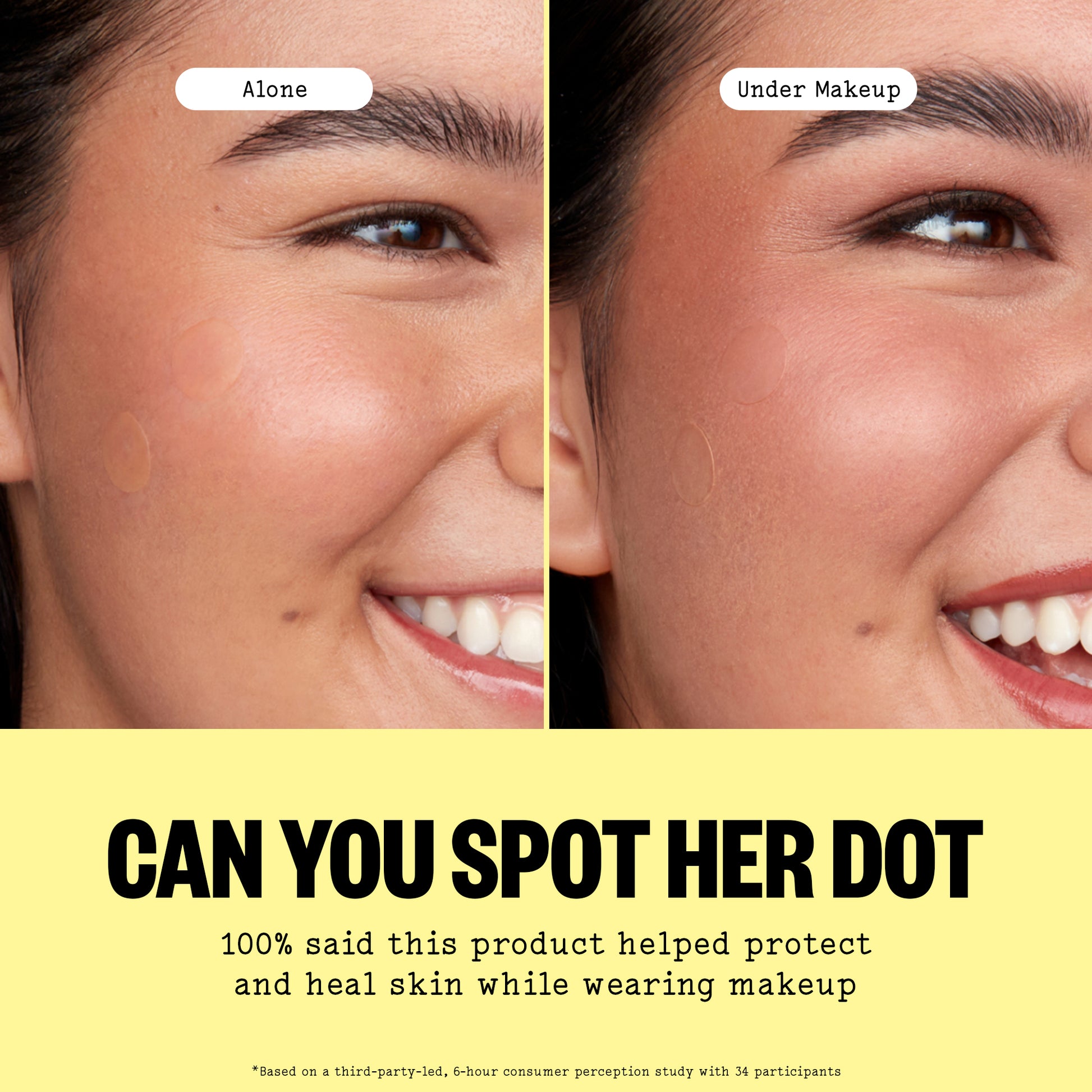 Before and after comparison of a woman's face with and without makeup, highlighting a spot. Text suggests Peace Out Acne Day & Night Duo helps protect skin.