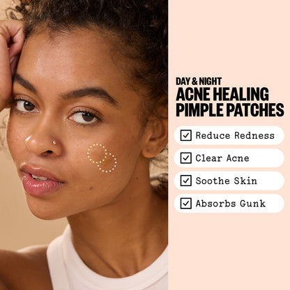 Woman with a Peace Out acne patch on her cheek beside on-image benefit text.