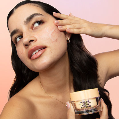 Before-and-after showing fewer breakouts after using Peace Out Acne Gel Moisturizer.