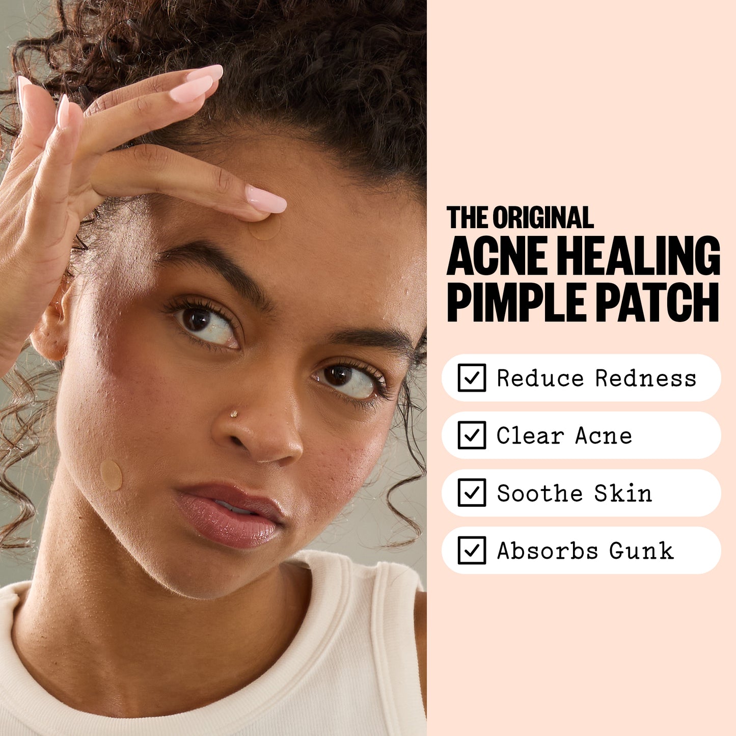 Woman with acne on her face next to text about acne treatment pimple patches