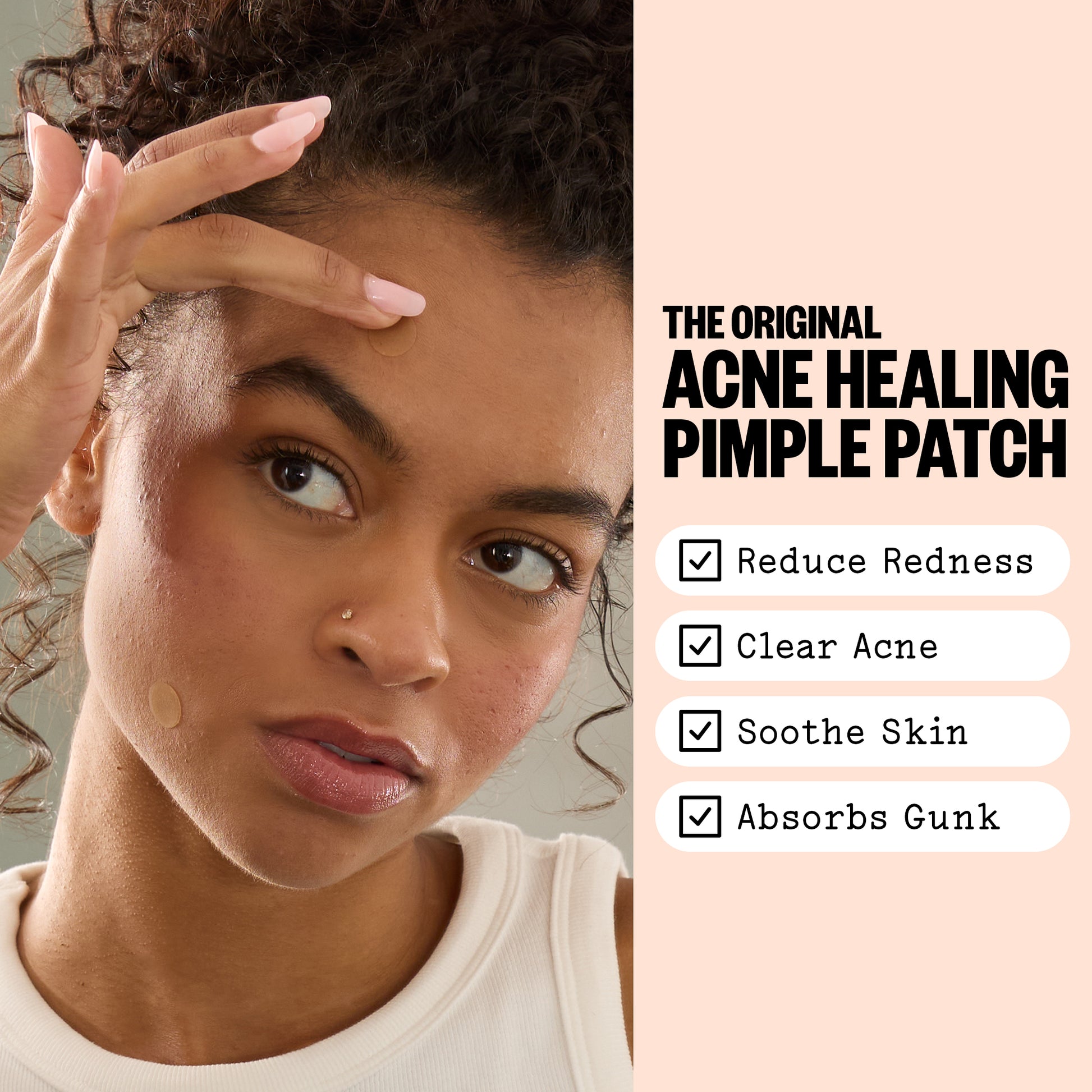 Woman with acne on her face next to text about acne treatment pimple patches