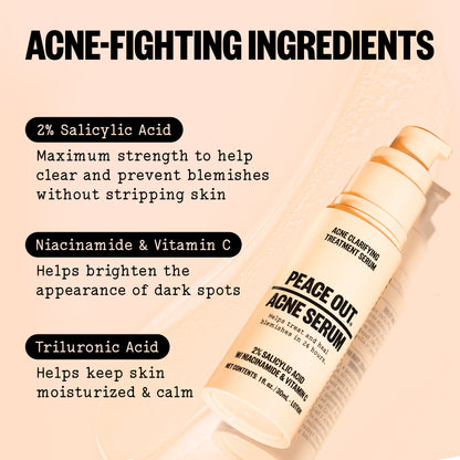 Peace Out Acne Serum with acne-fighting ingredients listed on a beige background
