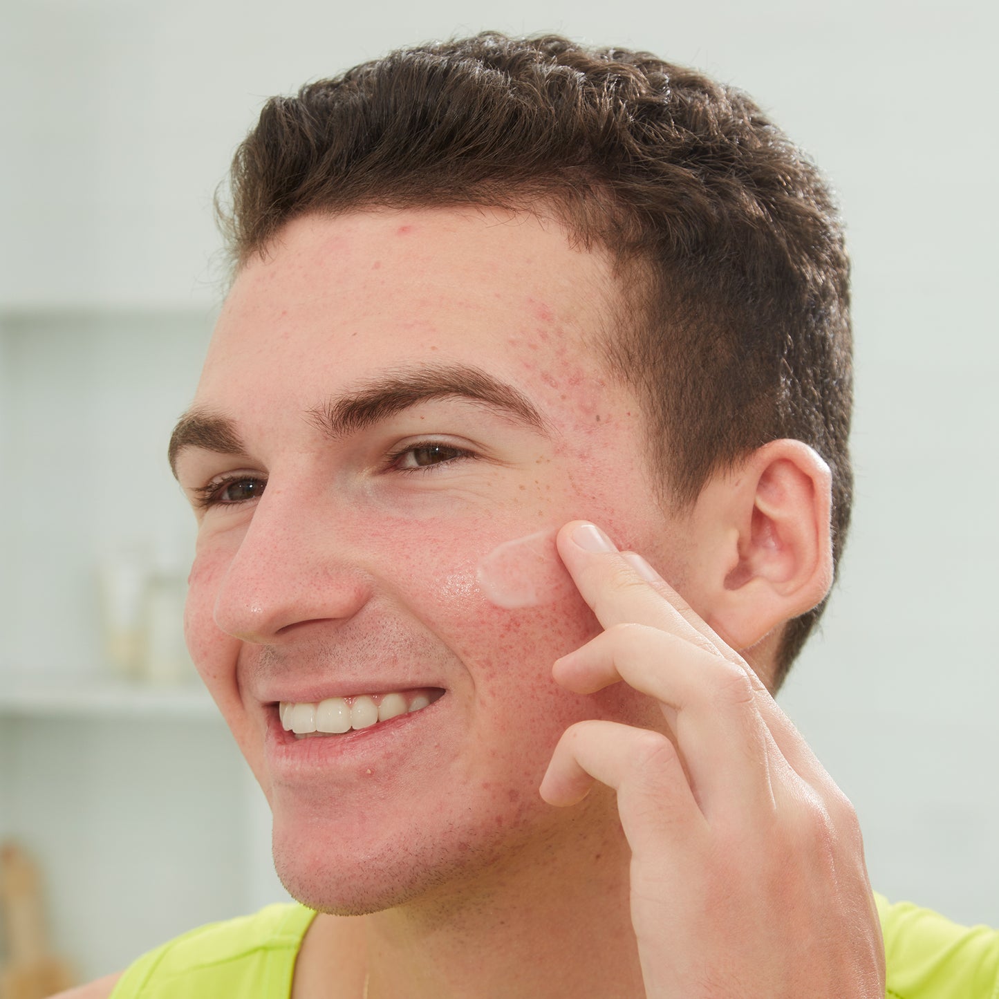 Acne Serum
