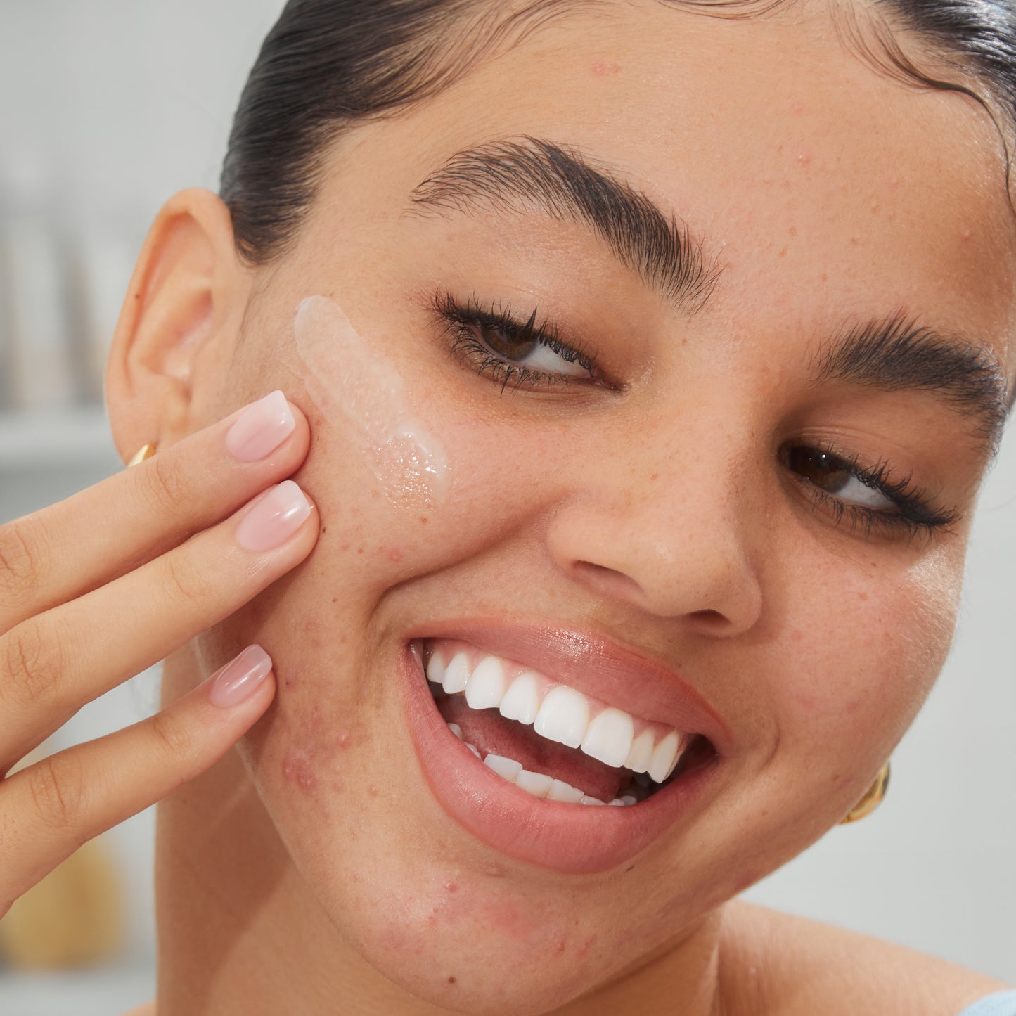 Acne Serum