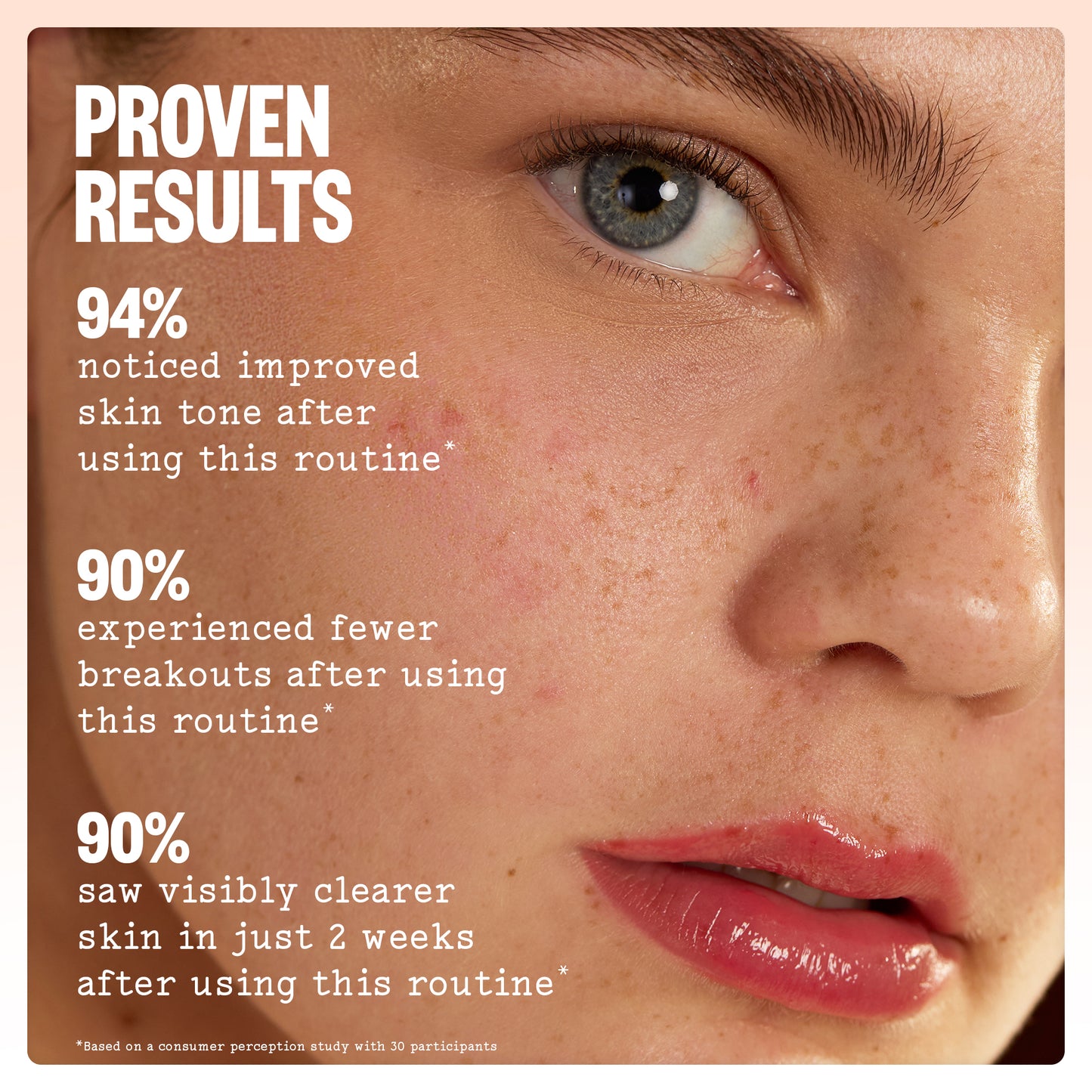 Close-up of a woman's face with text reading 'PROVEN RESULTS' and statistics about improved skin tone, fewer breakouts, and clearer skin after using the Acne Care Kit routine.
