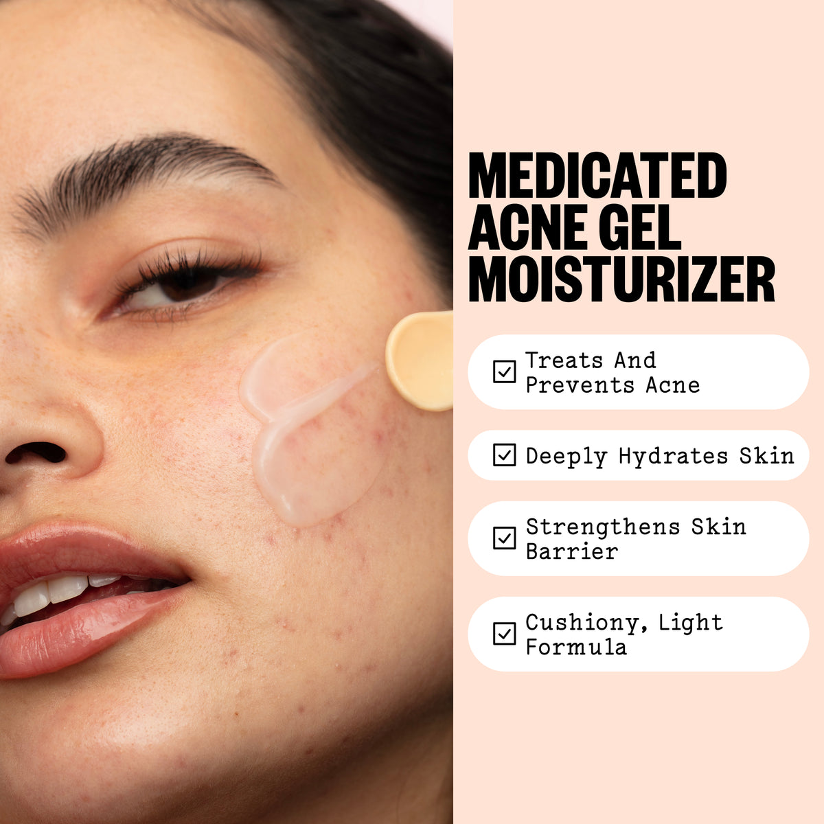 A woman applies Acne Gel Moisturizer to her cheek with 4 product benefits
