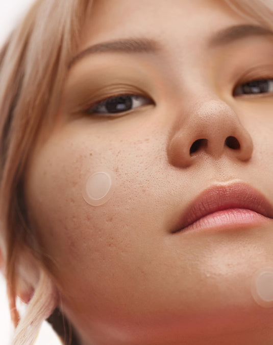 Dark Spots