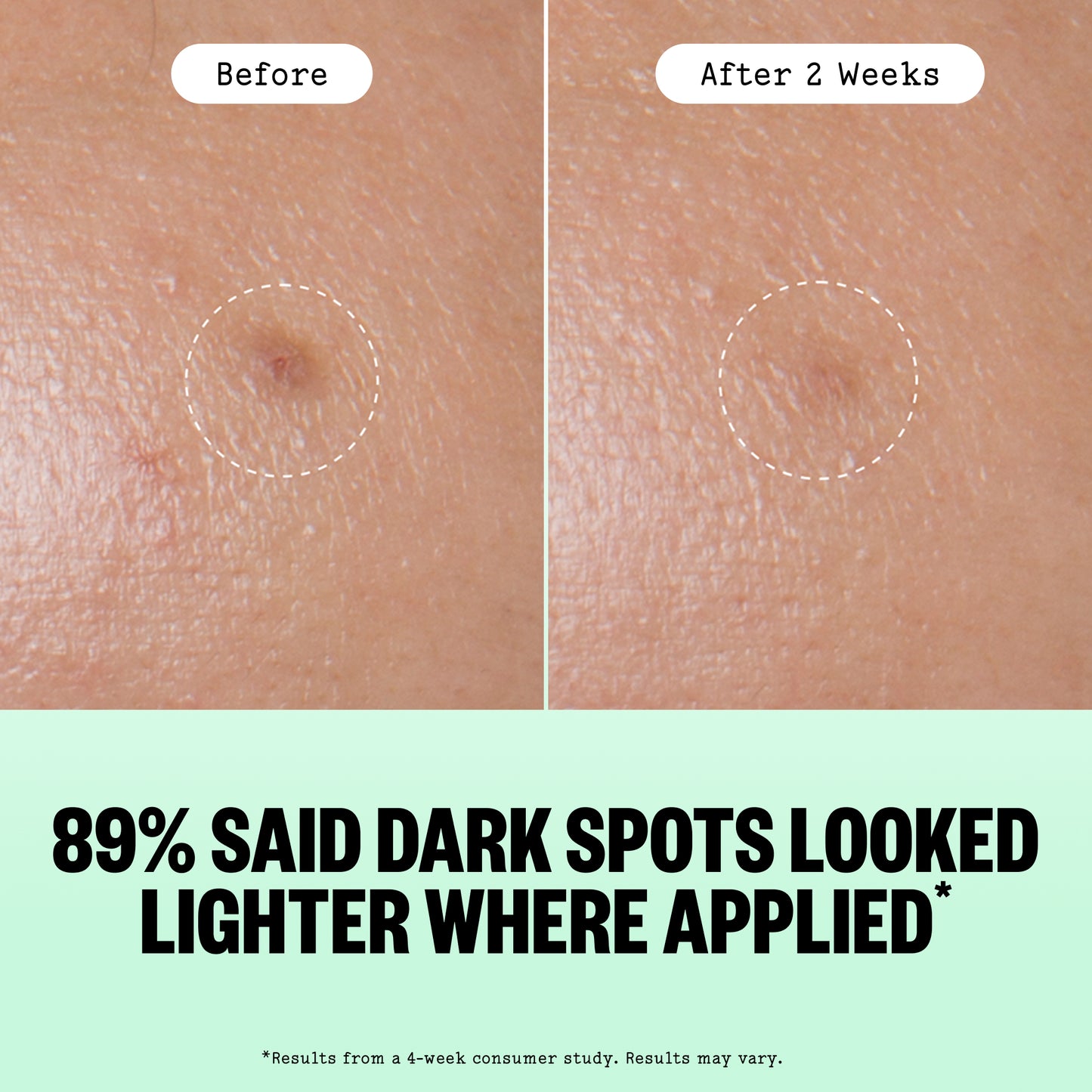 Before-and-after skin comparison showing a dark spot on skin labeled 'Before' and 'After 2 Weeks,' with large text below stating '89% SAID DARK SPOTS LOOKED LIGHTER WHERE APPLIED'.