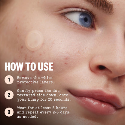 Close-up of a person's face with an Early Stage Acne Dot on the cheek and overlaid text reading 'HOW TO USE' with three steps for applying and wearing the product.