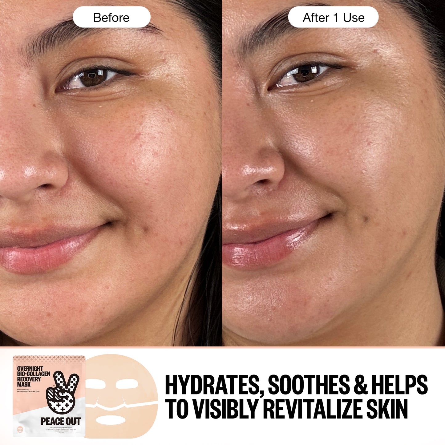 Before and After using the Overnight Bio-Collagen Recovery Mask after 1 use