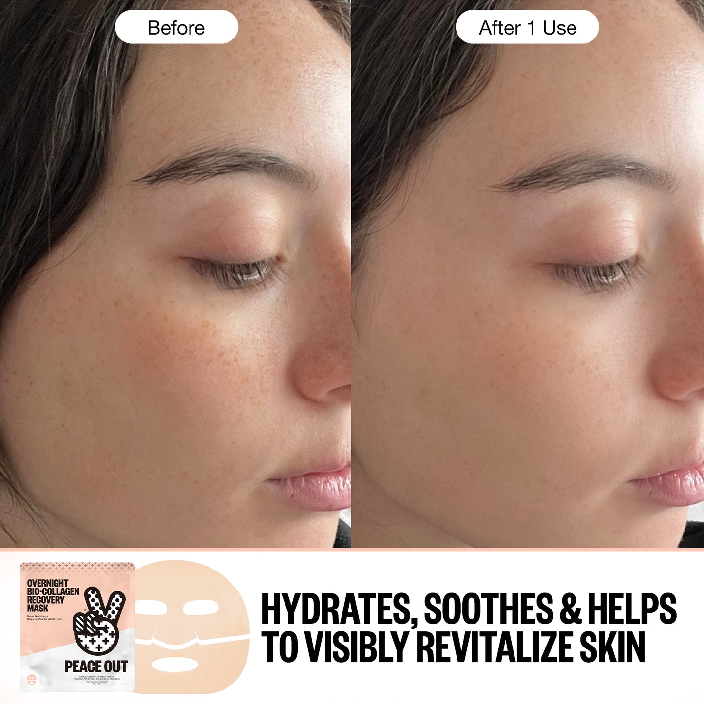 Another Before and After using the Overnight Bio-Collagen Recovery Mask after 1 use