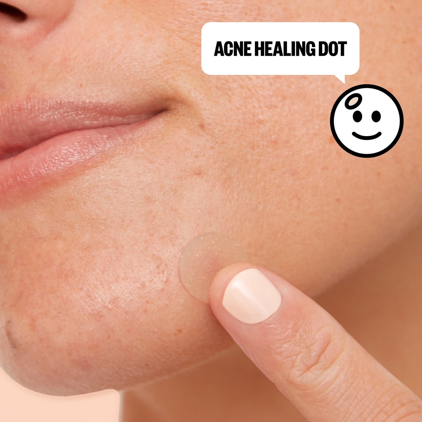 Acne Day & Night Duo (CAN)