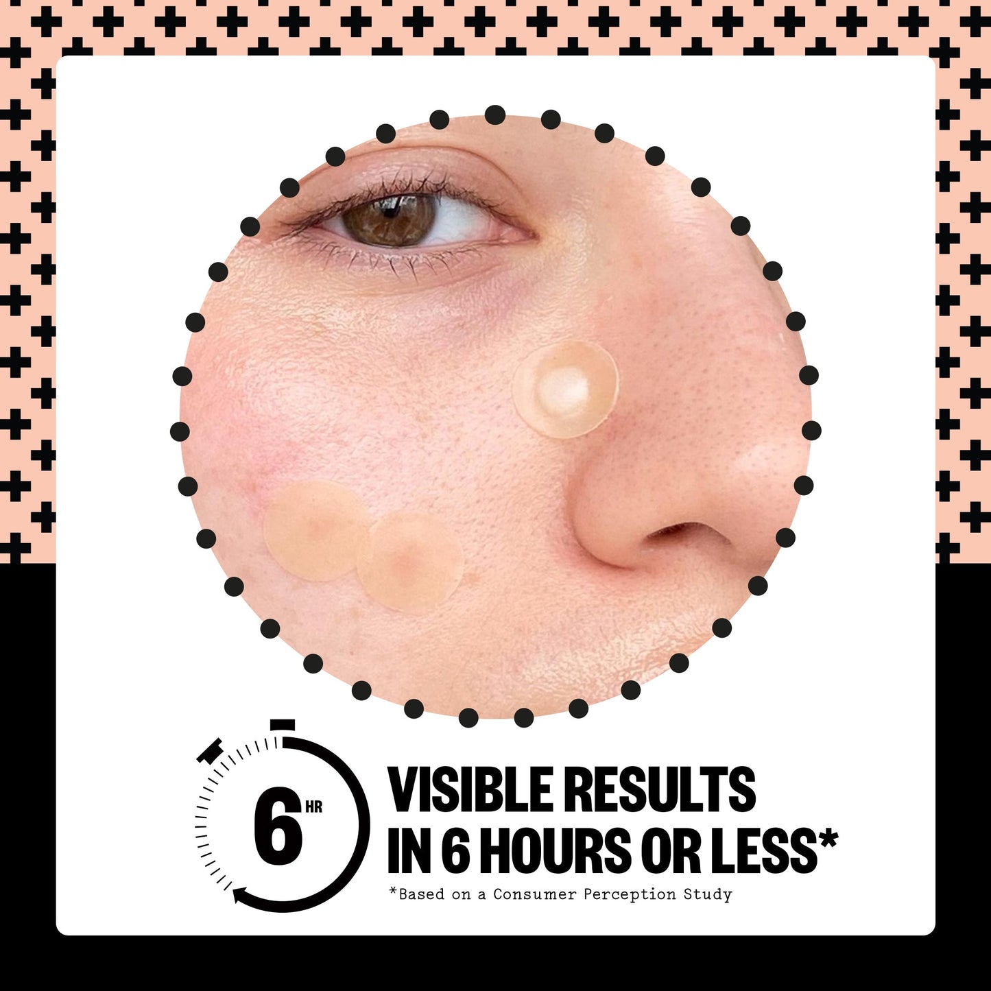 Acne Treatment Dots (CAN)