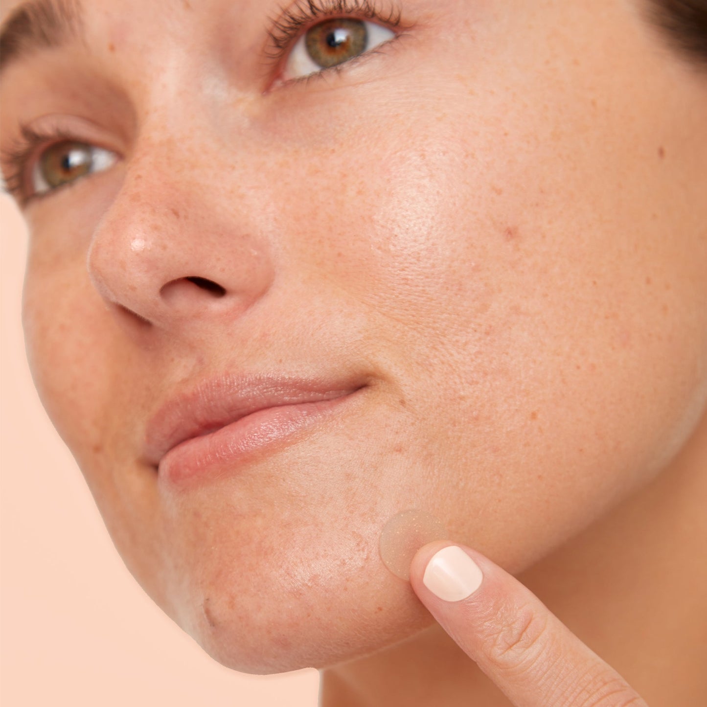 Acne Treatment Dots (CAN)