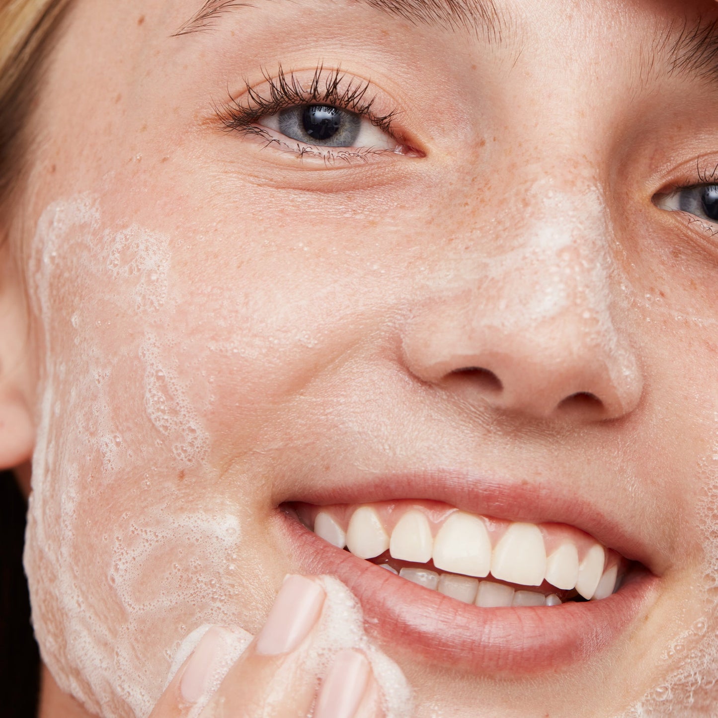 Acne Gel Cleanser (CAN)