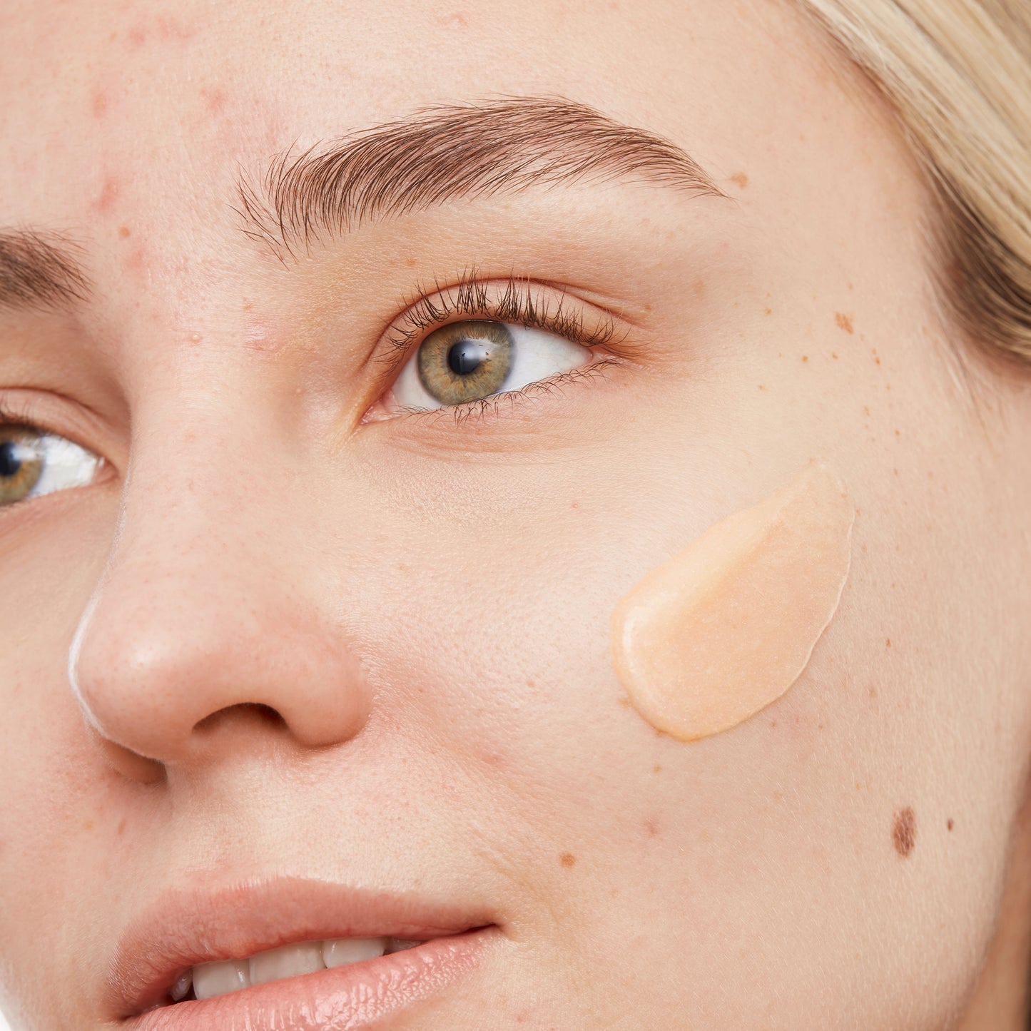 Acne Gel Cleanser