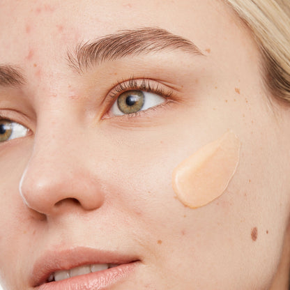 Acne Gel Cleanser (CAN)