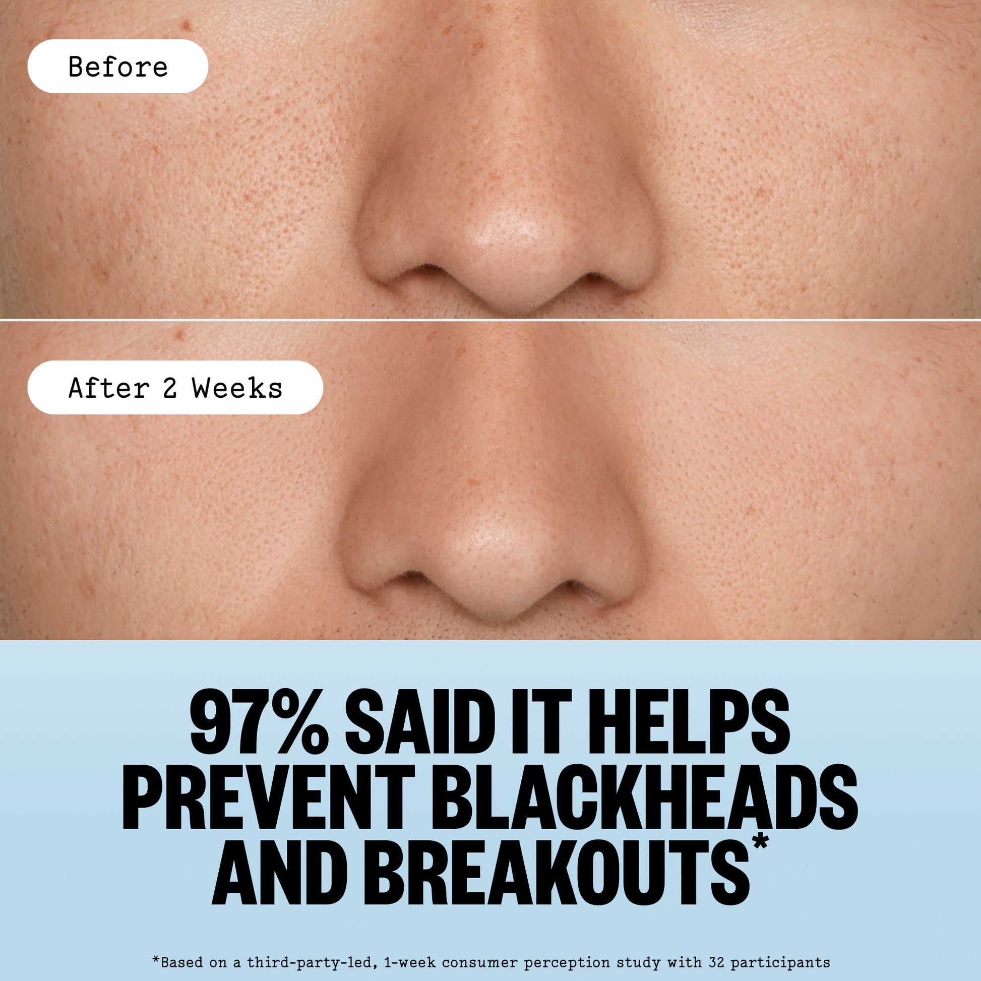 Before-and-after comparison of a person's nose skin showing clearer skin after 2 weeks of using Pore Perfecting Stick with text stating '97% SAID IT HELPS PREVENT BLACKHEADS AND BREAKOUTS'.