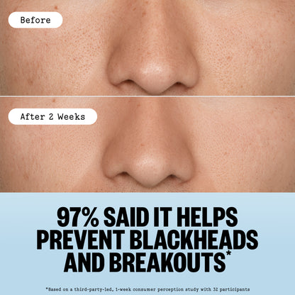 Before-and-after comparison of a person's nose skin showing clearer skin after 2 weeks of using Pore Perfecting Stick with text stating '97% SAID IT HELPS PREVENT BLACKHEADS AND BREAKOUTS'.