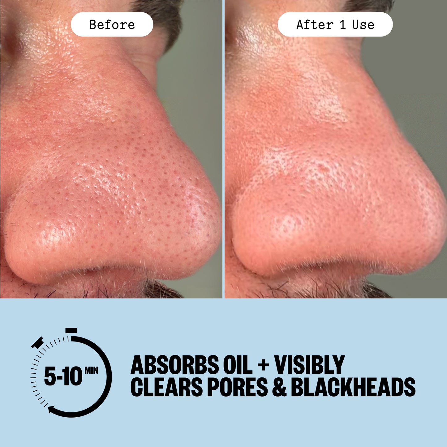 Before and after comparison of a person's nose showing pore improvement after using Peace Out Pore Refining Strips, with text reading 'Before', 'After 1 Use', and 'ABSORBS OIL + VISIBLY CLEARS PORES & BLACKHEADS' on a light blue background.