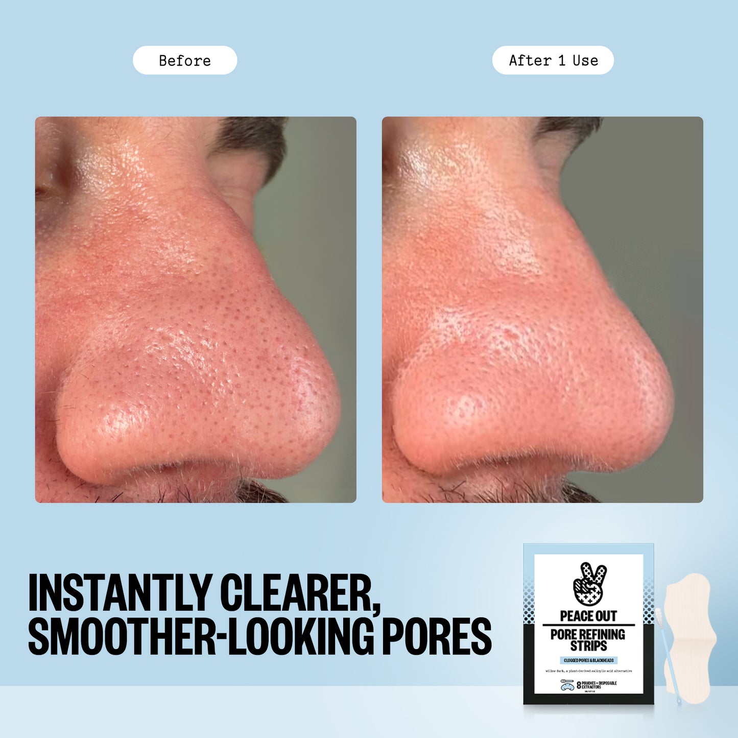 Pore Refining Strips CAN