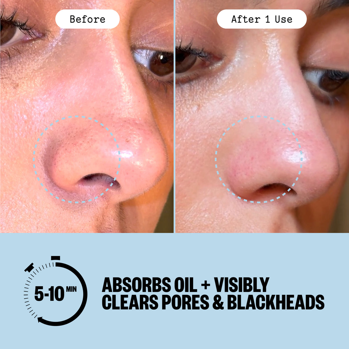 Before and after comparison of a person's nose showing oil reduction and pore clearing after using Peace Out Pore Refining Strips, with text stating 'After 1 Use' and 'Absorbs Oil + Visibly Clears Pores & Blackheads' on a light blue background.
