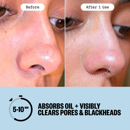 Before and after comparison of a person's nose showing oil reduction and pore clearing after using Peace Out Pore Refining Strips, with text stating 'After 1 Use' and 'Absorbs Oil + Visibly Clears Pores & Blackheads' on a light blue background.